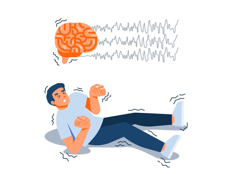 Stroke
